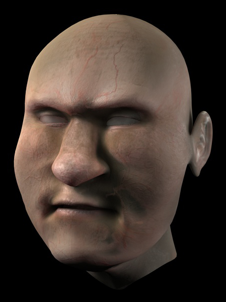 test subdermal 6.jpg