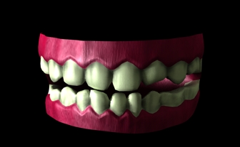 dentatura 1.jpg