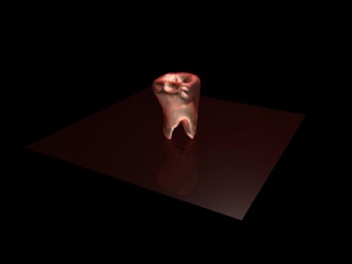 dente.jpg (15.67 KiB) Visto 790 volte dente.jpg